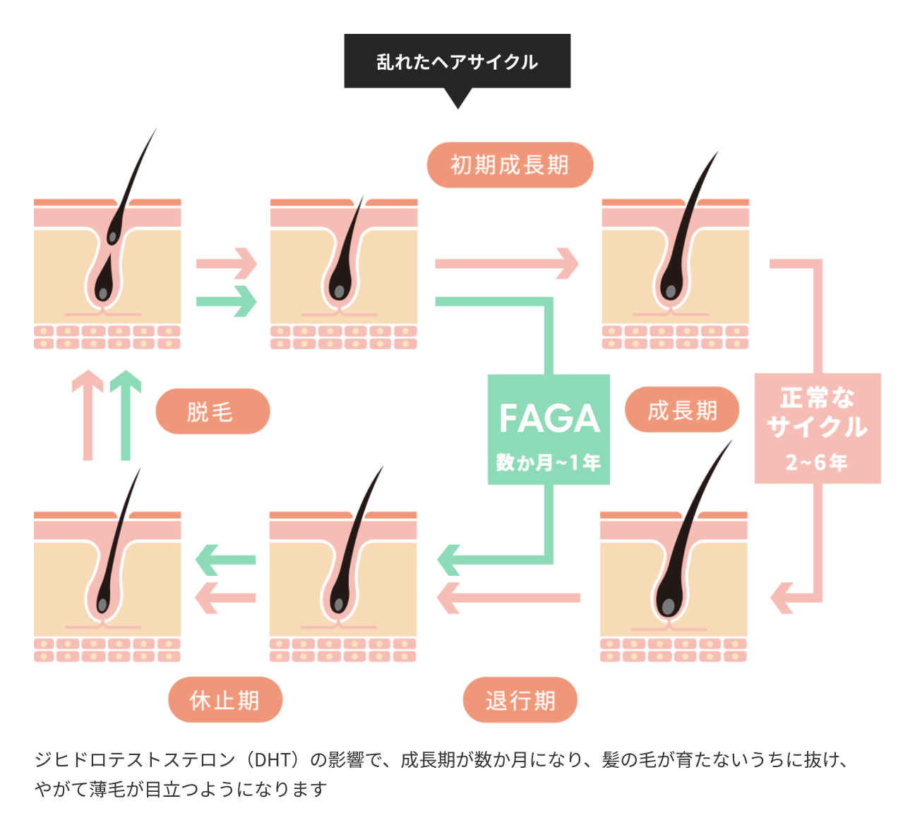 乱れたヘアサイクル