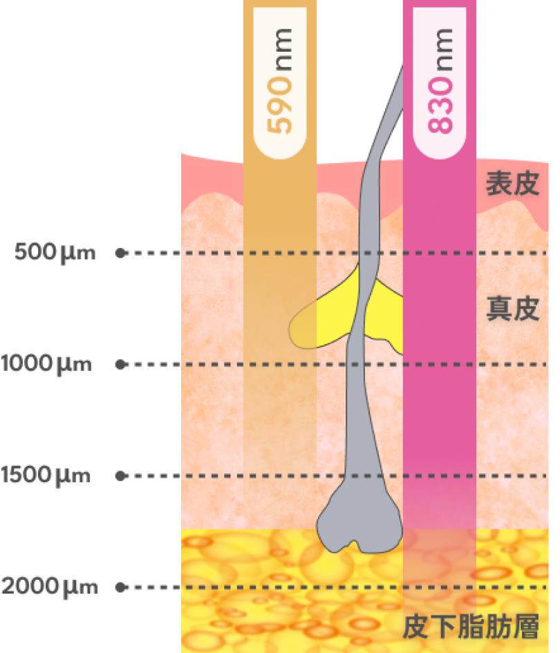 590nmから830nmへ 世界初の連続照射システム