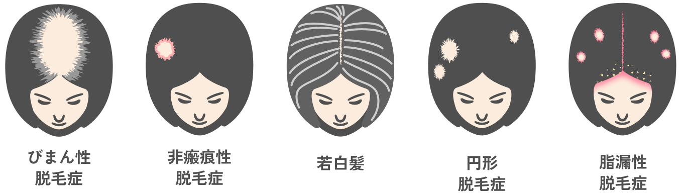 DR. CYJヘアフィラーの適用例
