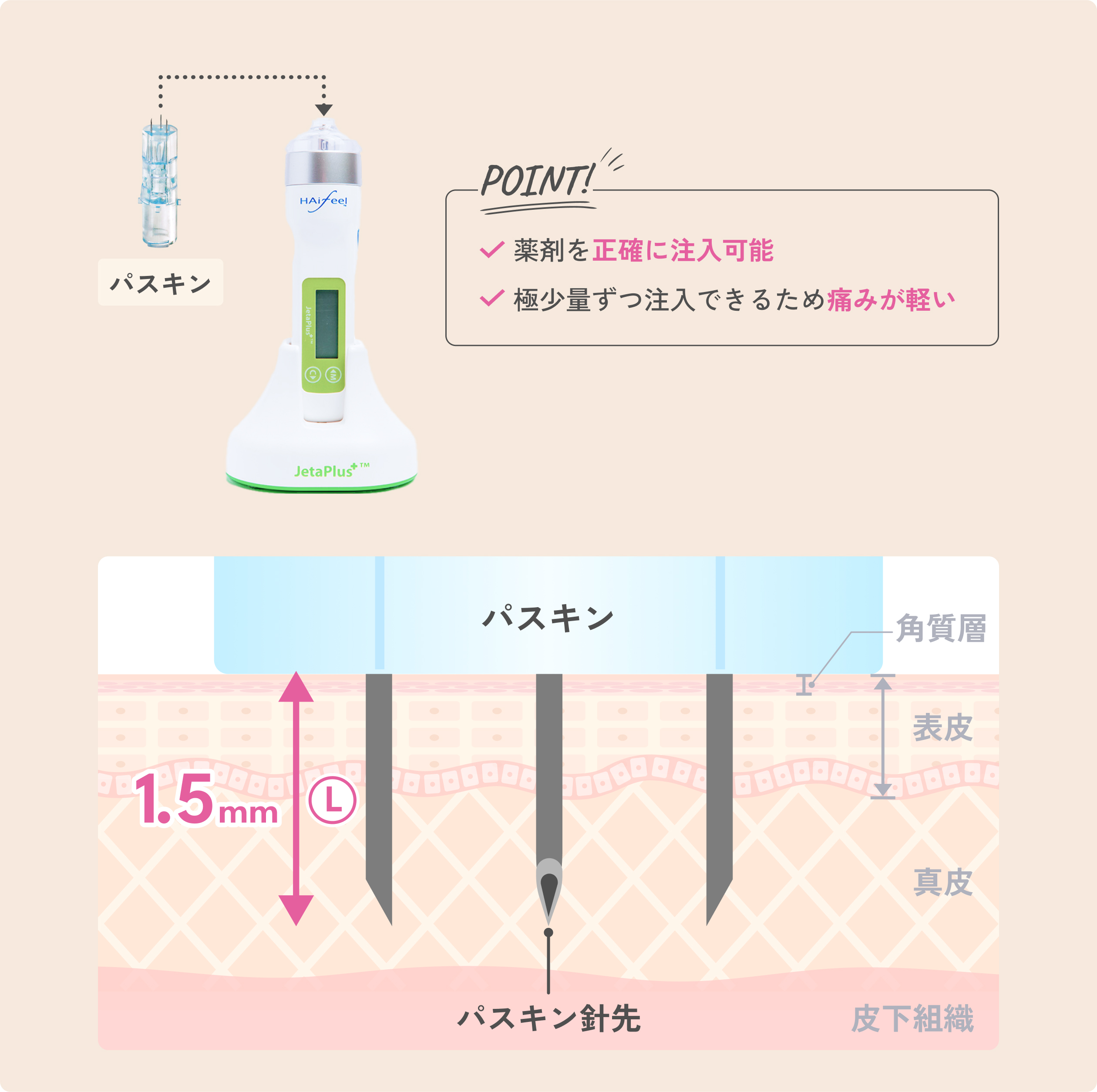 ハイジェッタの優れる点