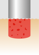 FRAC3 VECTOR